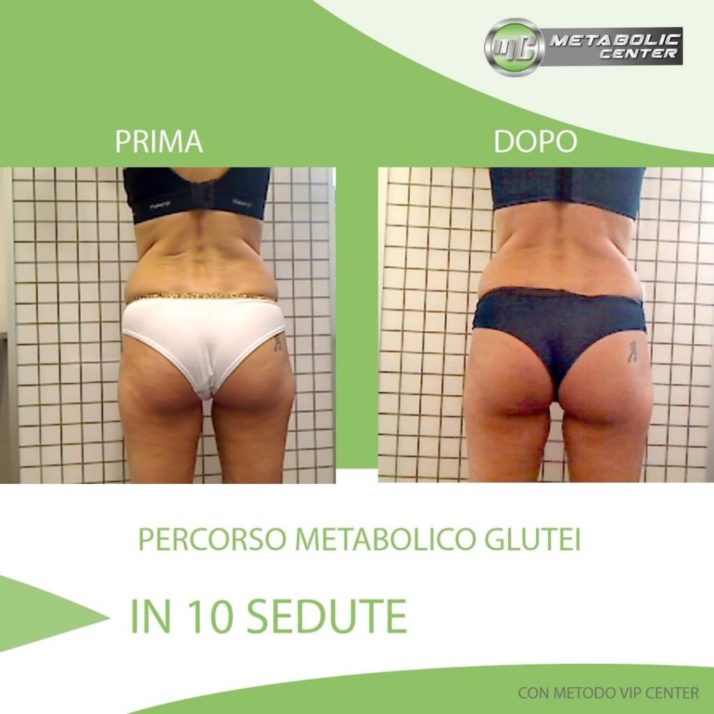 metabolic-prima-dopo-13-1024x1024